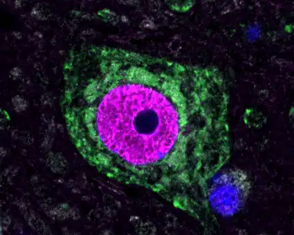 distribution of mutant fus protein in motor neuron