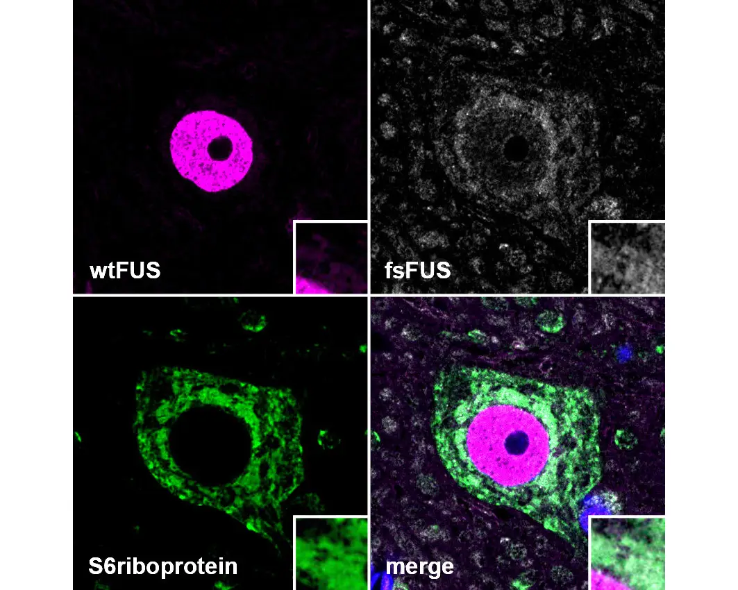 mutant fus in same location as structures identified from altered gene expression